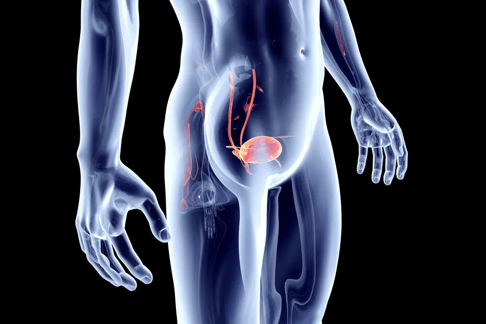 3D Bladder Screening